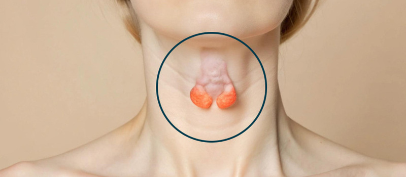 Types of Thyroid Cancer: Papillary, Follicular, Medullary & Anaplastic