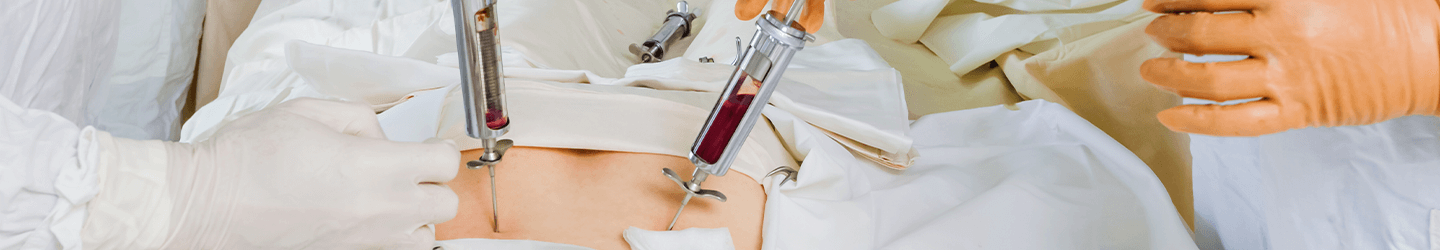 Bone Marrow Transplant in India – Advanced Stem Cell Therapy for Cancer