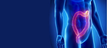 Colon & Rectal (Colorectal) Cancer