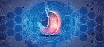 Stomach (Gastric) Cancer