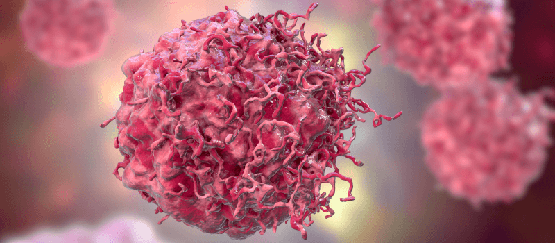 Understanding the Difference Between Neoplasm vs Cancer