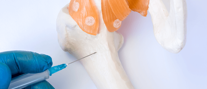 Bone Marrow Biopsy and Aspiration