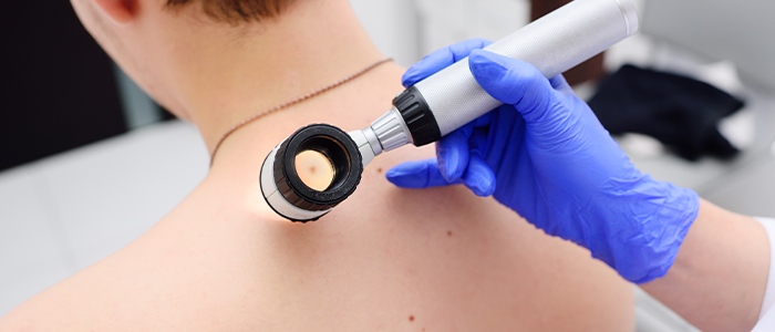 Top Skin Cancer Risk Factors During Winter